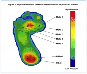 Raising heel height alters pressure variables in experienced high-heel wearers